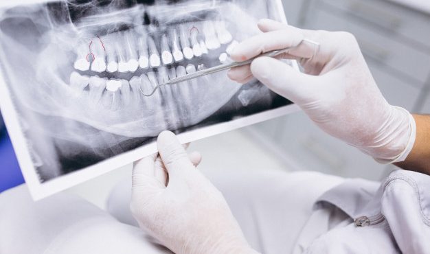 panoramic-xray-dental-surgery